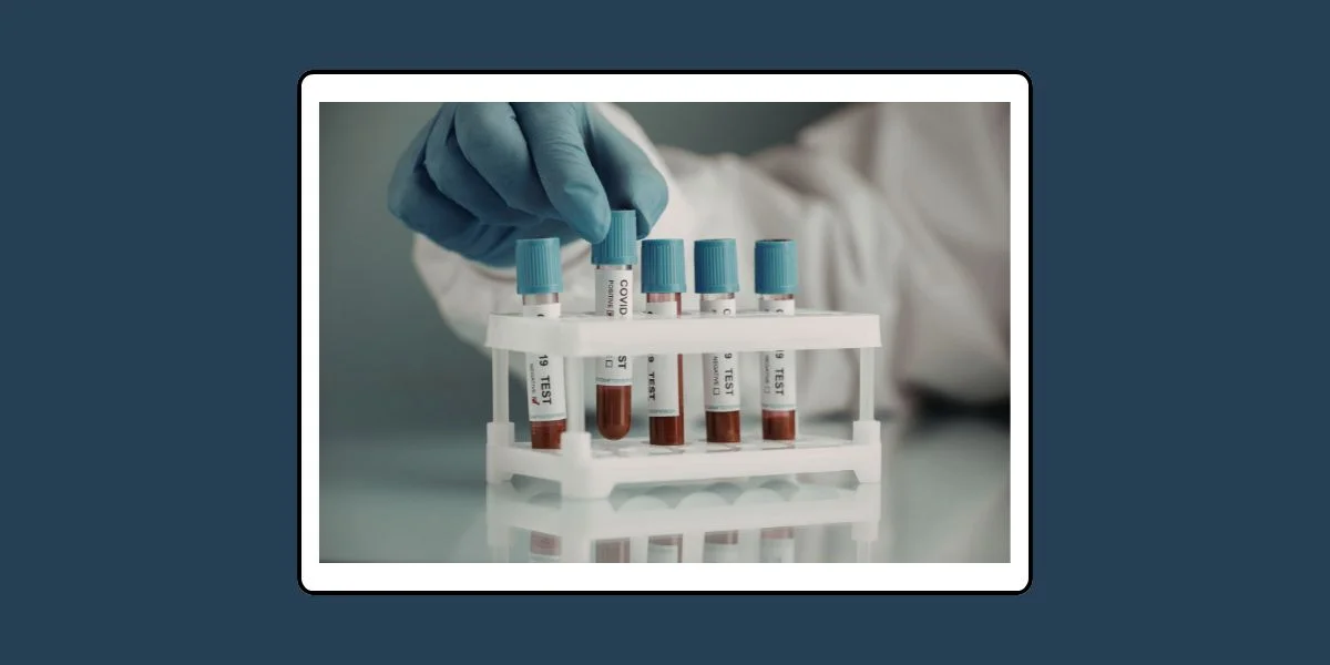 คำวินิจฉัย (ฟัตวา) จุฬาราชมนตรี ที่ 4/2557 เรื่อง การเจาะเลือด