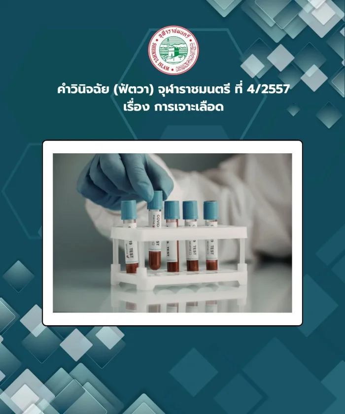 คำวินิจฉัย (ฟัตวา) จุฬาราชมนตรี ที่ 4/2557 เรื่อง การเจาะเลือด